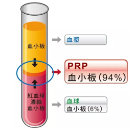 PRP技术+内热针技术学习